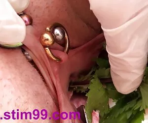 آناستوموز مجرای ادرار در عقرب و ولو عقرب